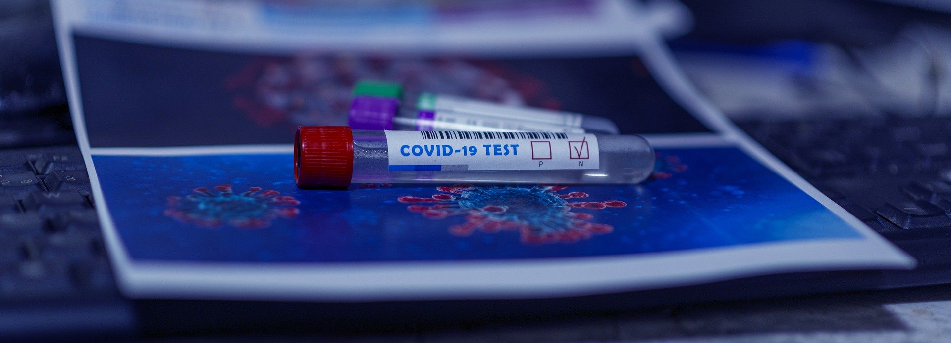 Россия направила в Доминикану около 4 тыс. тестов для выявления коронавируса