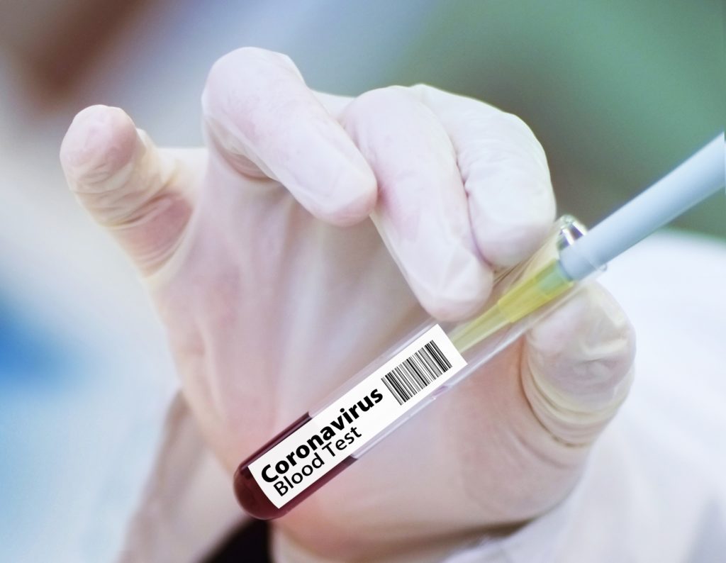 Создаваемую в России вакцину от коронавируса испытали на животных