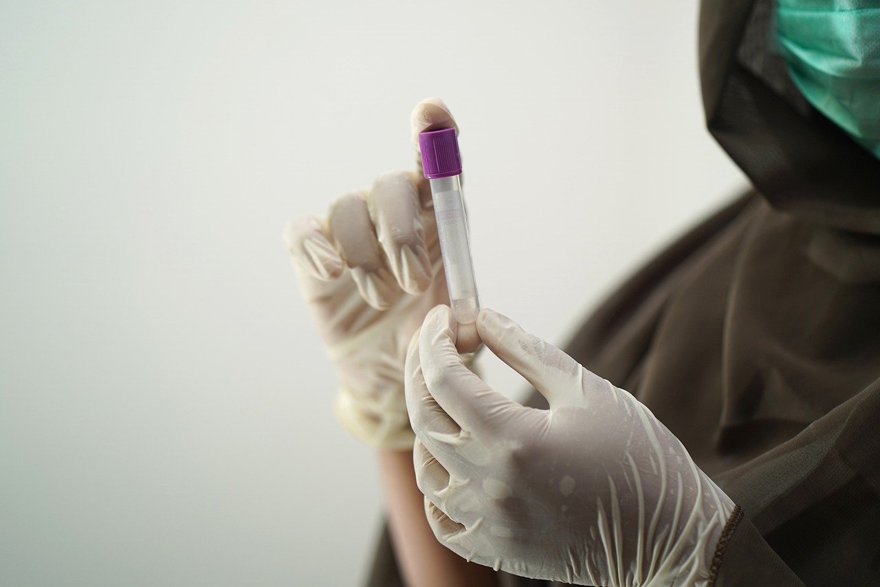 В России сделали более 63 млн тестов на коронавирус