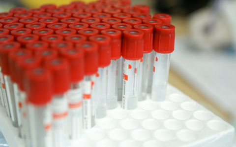 В Приморье увеличат количество пунктов антиковидной вакцинации