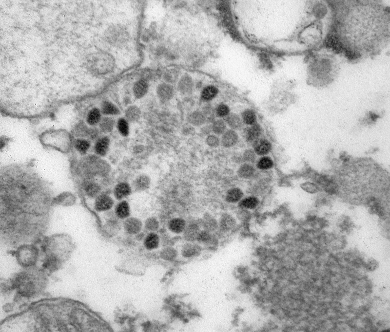 Центр «Вектор» опубликовал фото штамма коронавируса «Омикрон»