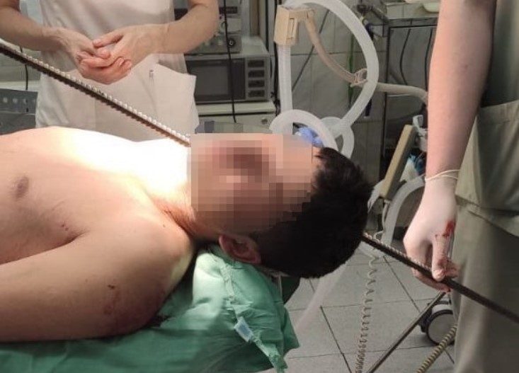 Родился в рубашке: В Подмосковье парень выжил после падения с высоты на арматуру